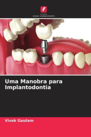 Knjiga Uma Manobra para Implantodontia Vivek Gautam