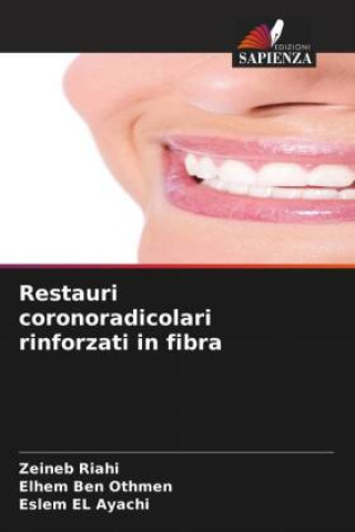 Knjiga Restauri coronoradicolari rinforzati in fibra Elhem Ben Othmen