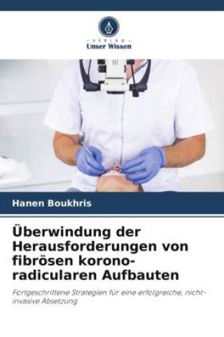 Libro Überwindung der Herausforderungen von fibrösen korono-radicularen Aufbauten 