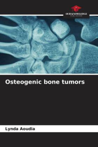 Knjiga Osteogenic bone tumors Lynda Aoudia