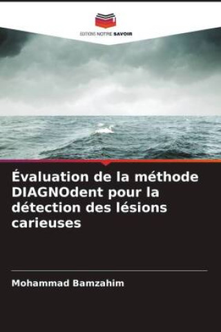 Libro Évaluation de la méthode DIAGNOdent pour la détection des lésions carieuses Mohammad Bamzahim