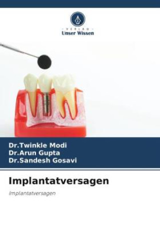 Kniha Implantatversagen Arun Gupta