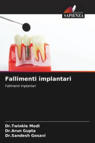 Book Fallimenti implantari Arun Gupta