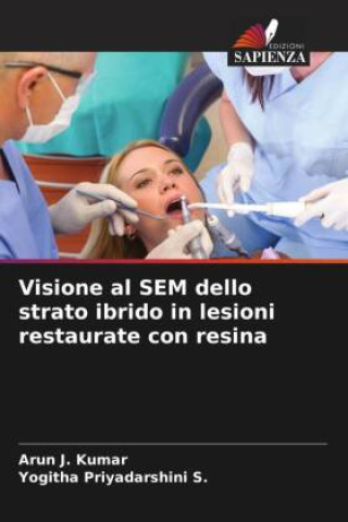 Kniha Visione al SEM dello strato ibrido in lesioni restaurate con resina Yogitha Priyadarshini S.