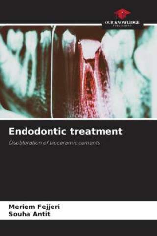 Boek Endodontic treatment Meriem Fejjeri