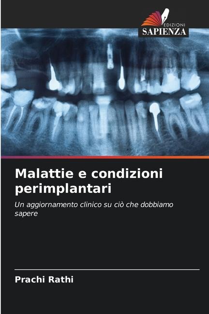 Libro Malattie e condizioni perimplantari Prachi Rathi
