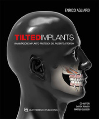 Kniha Tilted implants. Riabilitazione implanto-protesica del paziente atrofico Enrico Agliardi