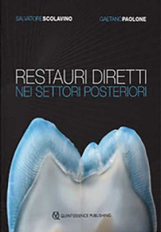 Könyv Restauri diretti nei settori posteriori Salvatore Scolavino