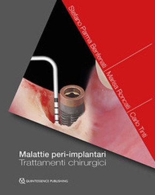Book Malattie peri-implantari. Trattamenti chirurgici Stefano Parma Benfanti