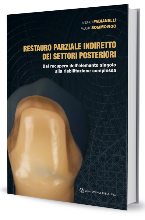 Книга Restauro parziale indiretto dei settori posteriori. Dal recupero dell'elemento singolo alla riabilitazione complessa Andrea Fabianelli