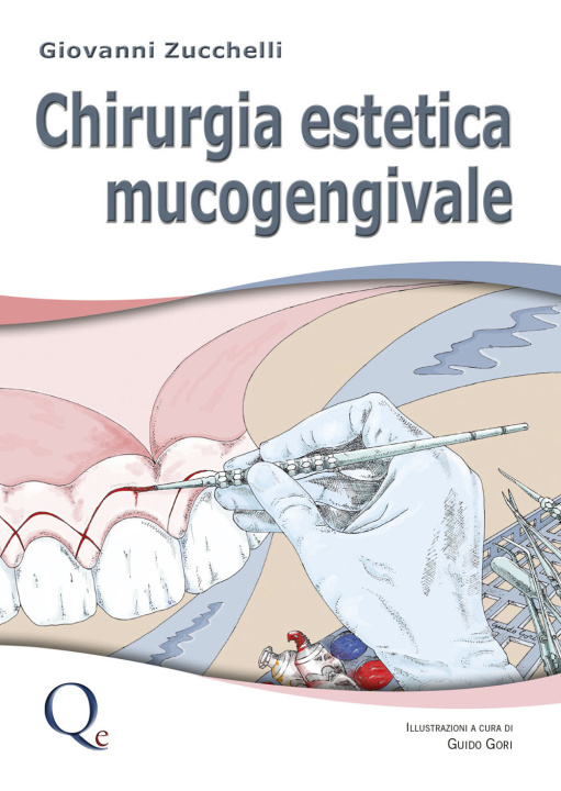 Kniha Chirurgia estetica mucogengivale Giovanni Zucchelli