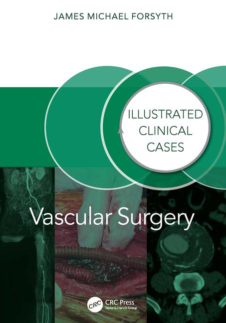 Libro Vascular Surgery: James Forsyth