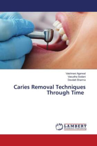 Knjiga Caries Removal Techniques Through Time Vasudha Sodani