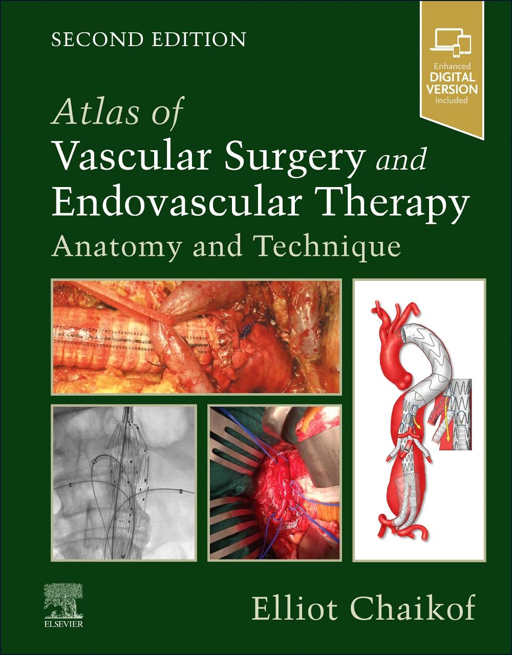 Kniha Atlas of Vascular Surgery and Endovascular Therapy Elliot L. Chaikof