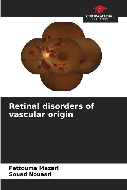 Knjiga Retinal disorders of vascular origin Fettouma Mazari
