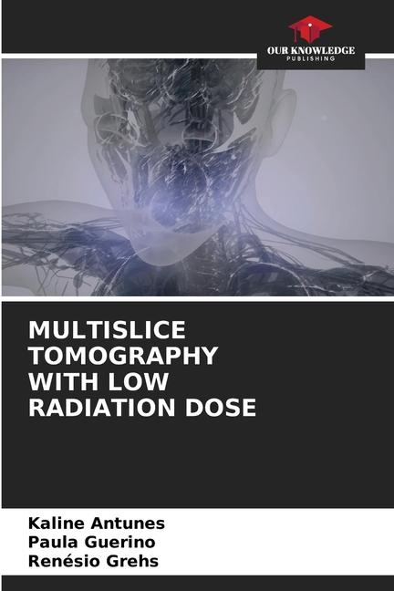 Libro MULTISLICE TOMOGRAPHY WITH LOW RADIATION DOSE Kaline Antunes