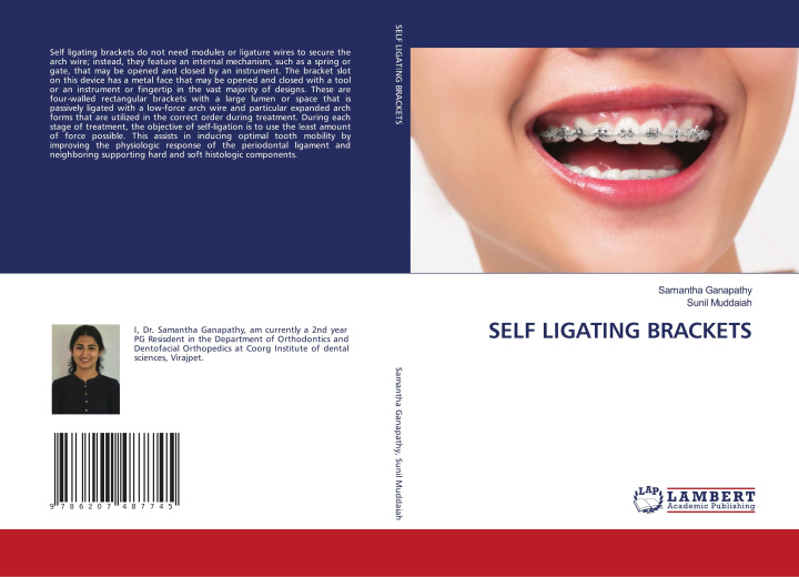 Knjiga SELF LIGATING BRACKETS Sunil Muddaiah