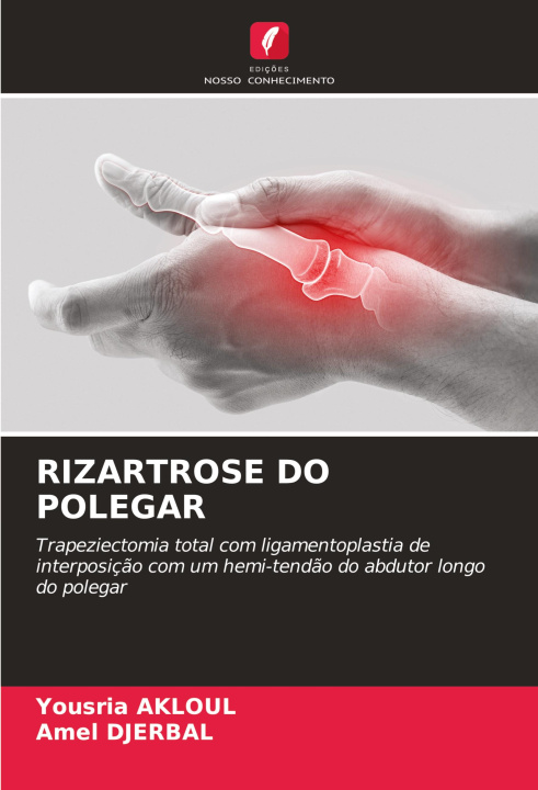Buch RIZARTROSE DO POLEGAR Yousria AKLOUL