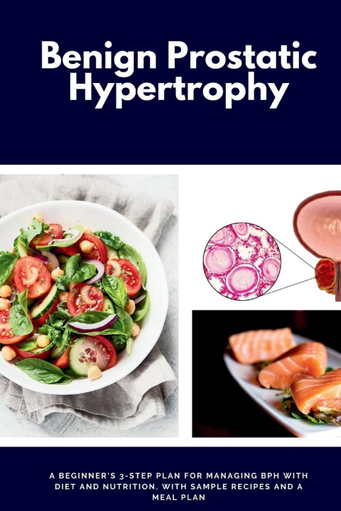 Knjiga Benign Prostatic Hypertrophy Larry Jamesonn
