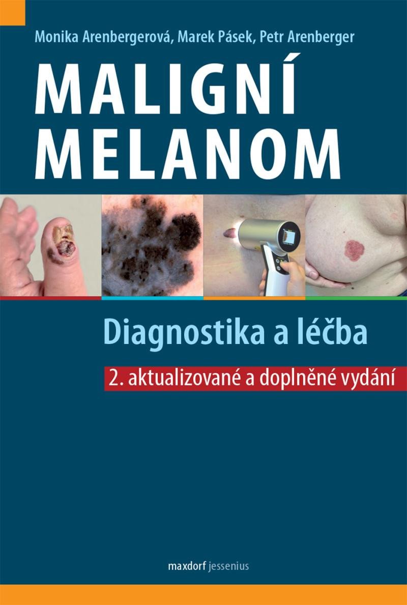 Book Maligní melanom - Diagnostika a léčba Monika Arenbergerová