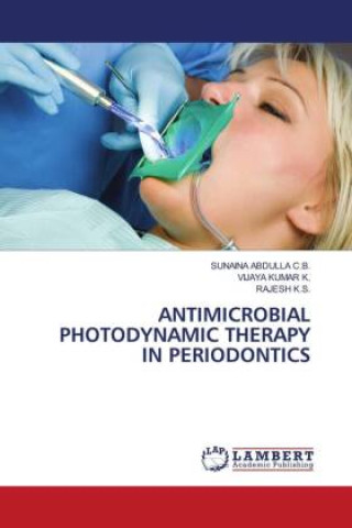 Knjiga ANTIMICROBIAL PHOTODYNAMIC THERAPY IN PERIODONTICS SUNAINA ABDULLA C.B.