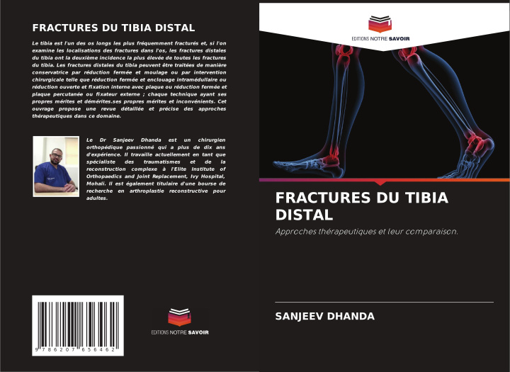 Knjiga FRACTURES DU TIBIA DISTAL Sanjeev Dhanda