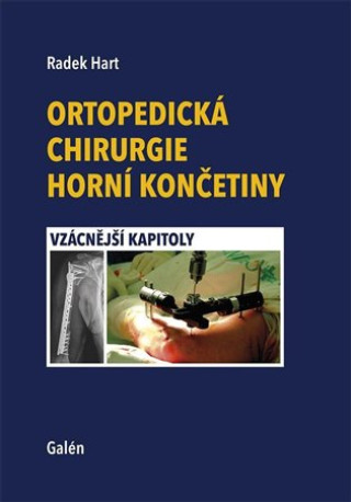 Książka Ortopedická chirurgie horní končetiny Radek Hart