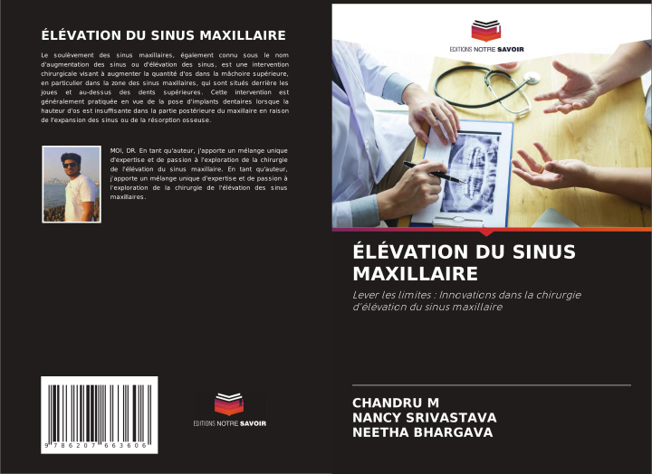 Knjiga ÉLÉVATION DU SINUS MAXILLAIRE Nancy Srivastava