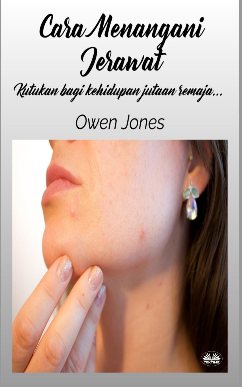Книга Cara Menangani Jerawat Owen Jones