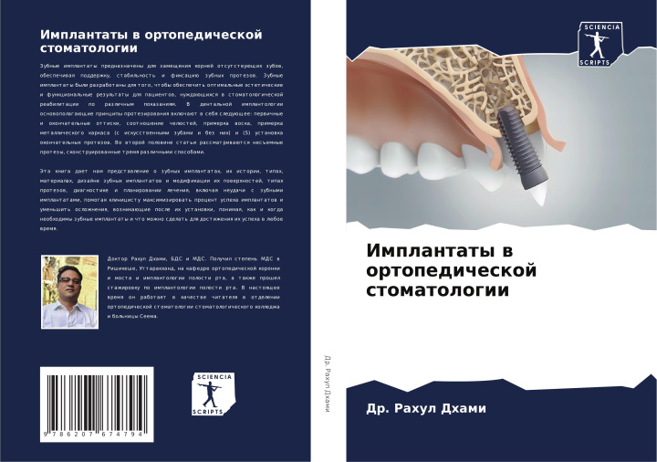 Книга Implantaty w ortopedicheskoj stomatologii Dr. Rahul Dhami