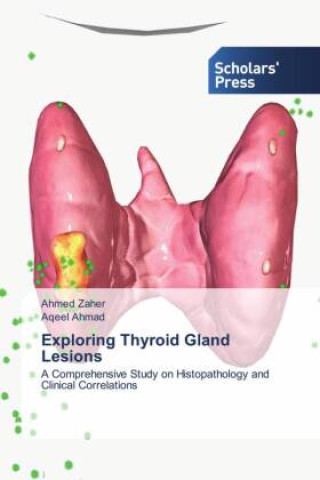 Knjiga Exploring Thyroid Gland Lesions Aqeel Ahmad
