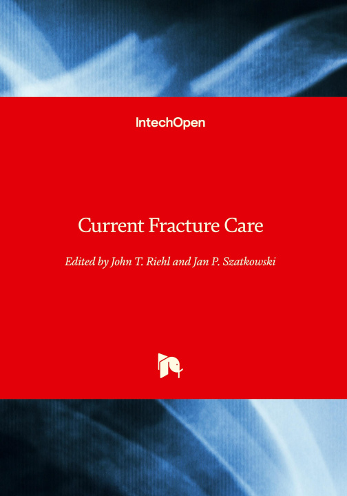 Buch Current Fracture Care Jan Szatkowski