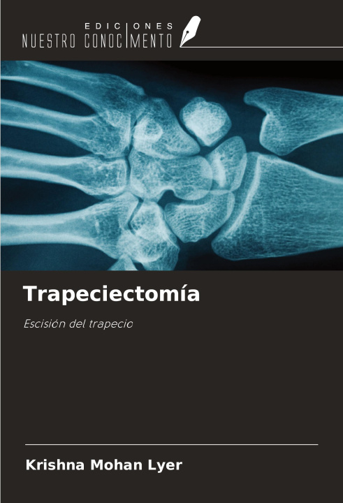 Knjiga Trapeciectomía 