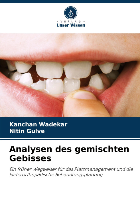 Libro Analysen des gemischten Gebisses Nitin Gulve