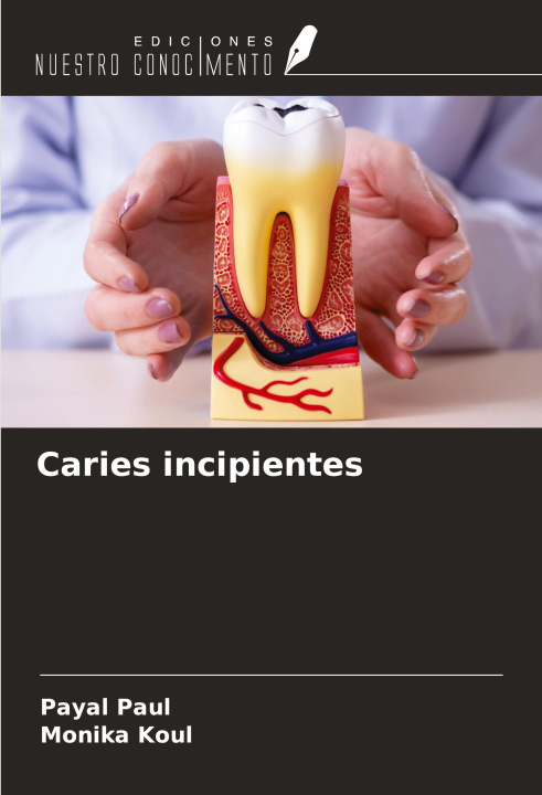 Book Caries incipientes Monika Koul