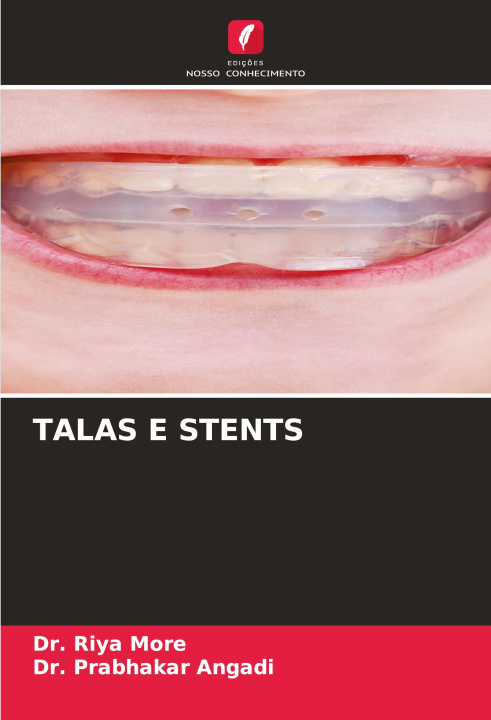 Knjiga TALAS E STENTS Prabhakar Angadi