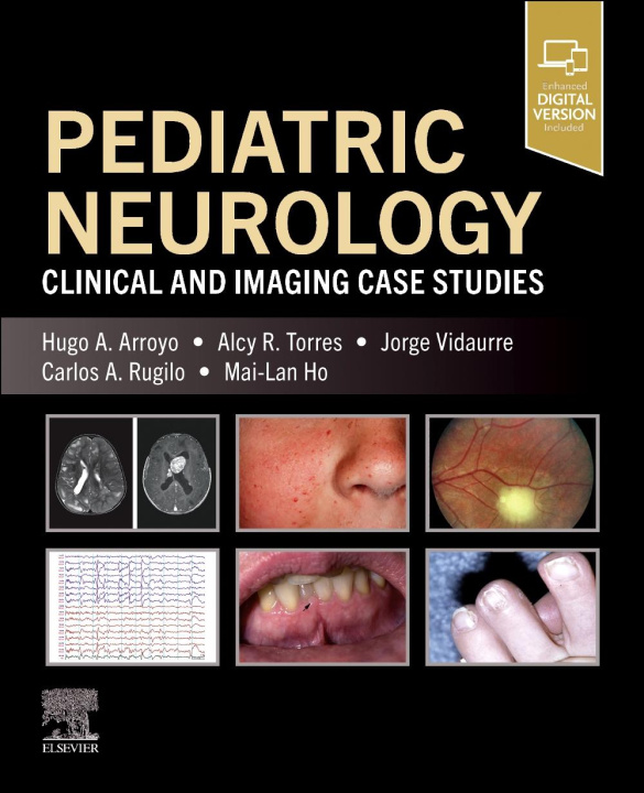 Книга Pediatric Neurology Hugo A. Arroyo