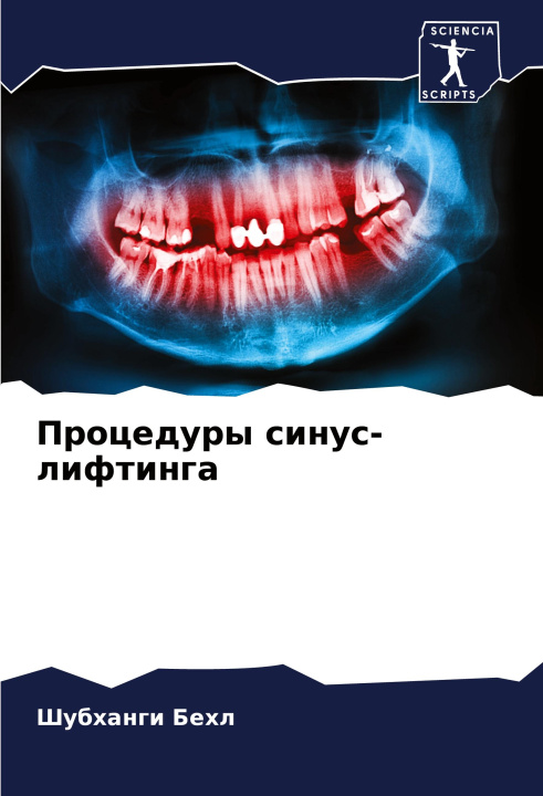 Knjiga Procedury sinus-liftinga Шубханги Бехл