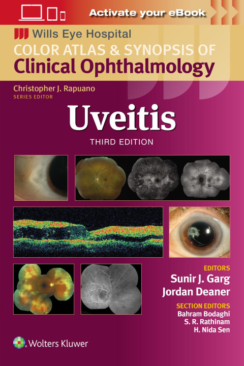 Βιβλίο Uveitis Garg