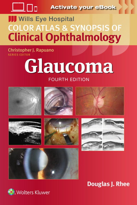 Book Glaucoma Rhee