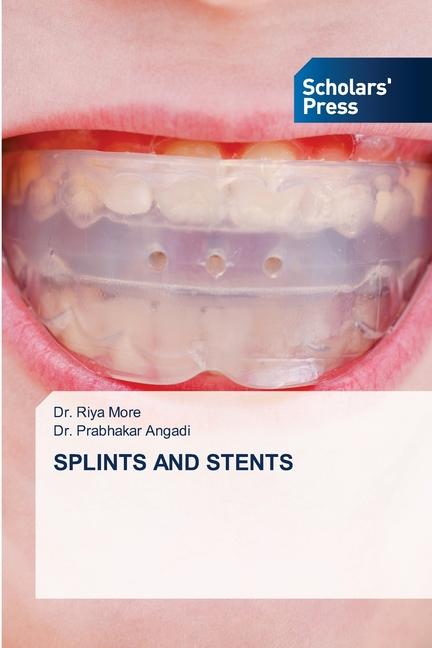 Knjiga Splints and Stents Prabhakar Angadi