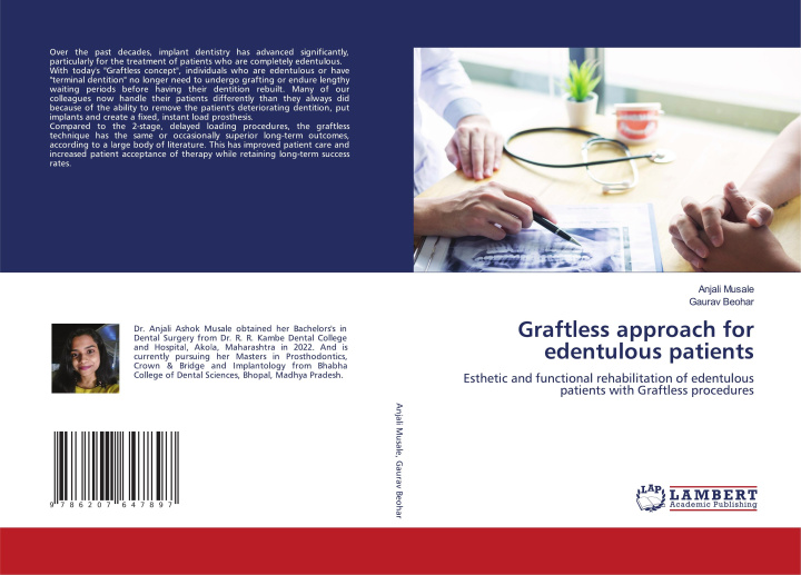 Knjiga Graftless approach for edentulous patients Gaurav Beohar