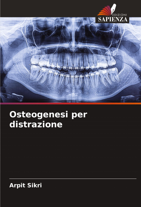 Carte Osteogenesi per distrazione Arpit Sikri