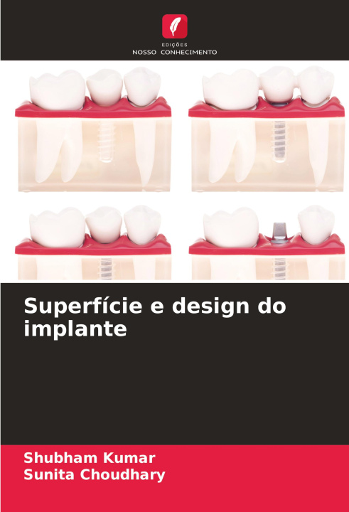 Knjiga Superfície e design do implante Sunita Choudhary