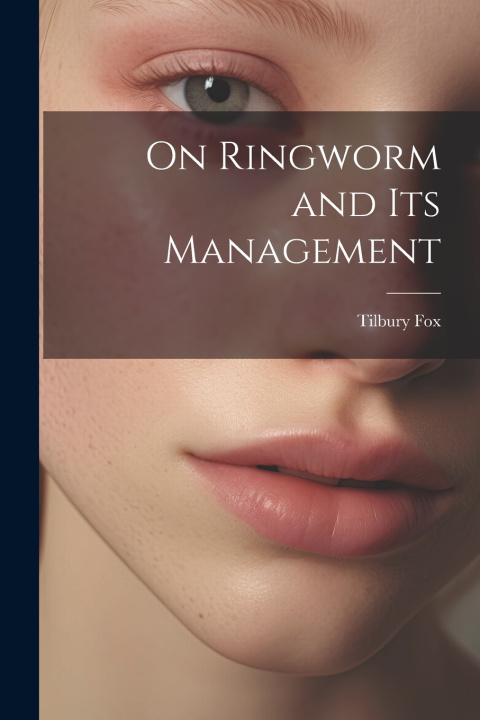 Libro On Ringworm and Its Management Tilbury Fox