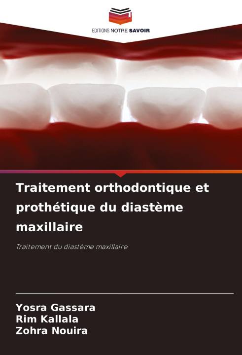 Livro Traitement orthodontique et prothétique du diast?me maxillaire Rim Kallala