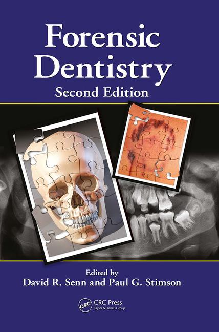 Book Forensic Dentistry Paul G. Stimson