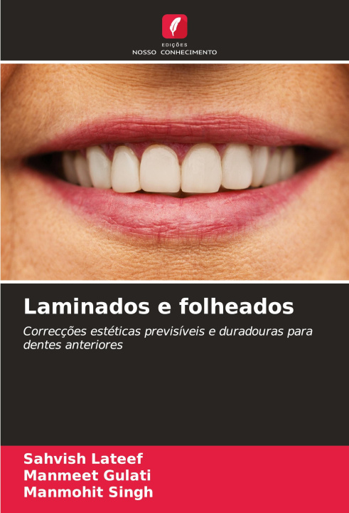 Kniha Laminados e folheados Manmeet Gulati