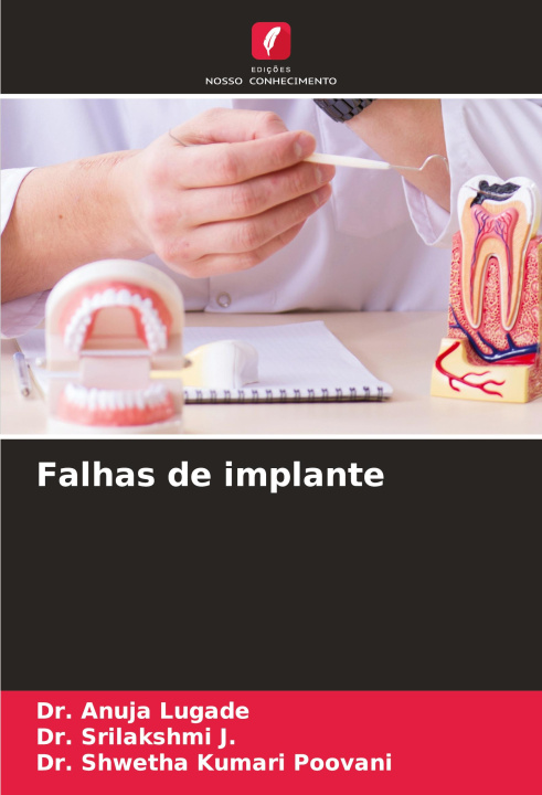 Boek Falhas de implante Srilakshmi J.