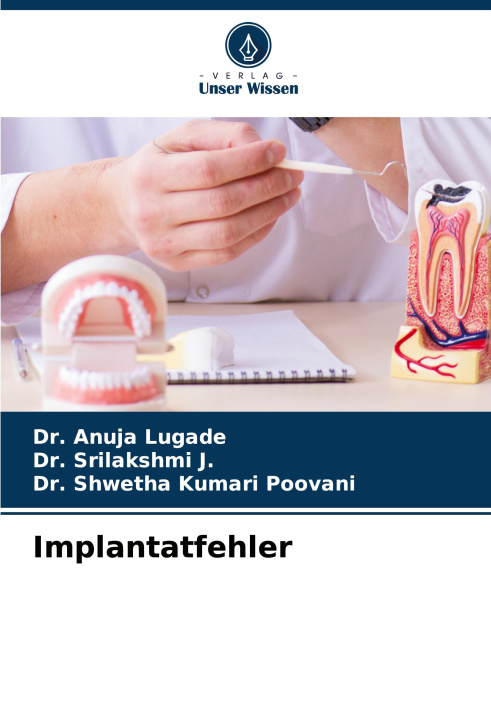 Buch Implantatfehler Srilakshmi J.